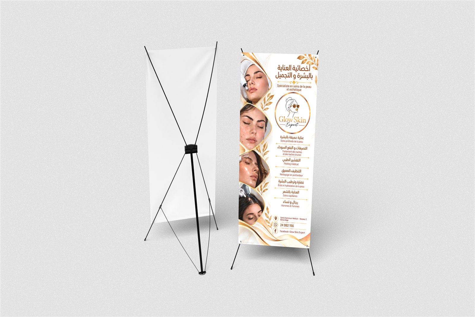 X-banner — X-banner